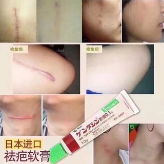 MSD Scar Removal Cream 🇯🇵 (Japan)